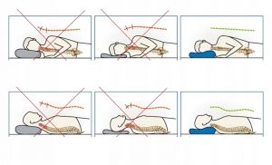 Ortopedinė pagalvė tinkamai stuburo laikysenai miegui